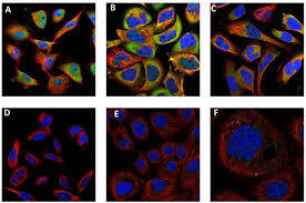 सैफायर कैलप्रोटेक्टिन S100A9