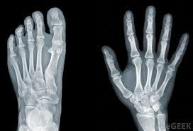 Digital X-Ray Services By MODERN DIAGNOSTIC CENTRE