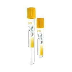 Gel & Clot Activator Tube - 13x75mm, 13x100mm, 16x100mm Sizes | Rapid Coagulation, Serum Separation, Hemolysis Prevention