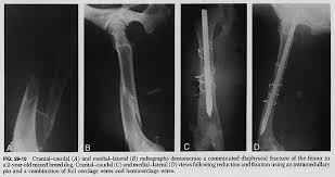 पिन और वायर