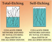 Self-etch Technology