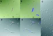  Zinc Mobilizing Bacteria