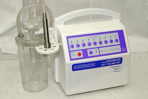 Gynecologic Vacuum Aspirator For Abortion With Foot-operated Remote Control