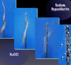 Sodium Hypochlorite