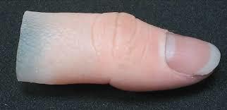 Functional Prosthetic Long Stump Silicone Prosthesis Finger, Myoelectric at  Rs 10500 in Vadodara