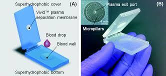 Optimum Quality Blood Plasma Separator