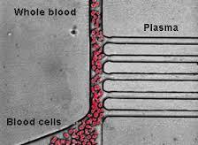 Robust Design Blood Plasma Separator