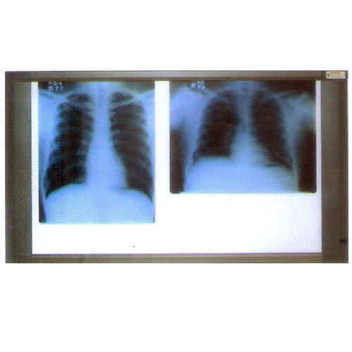 X Ray View Two Screen