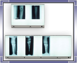 Rectangular X-Ray Viewer