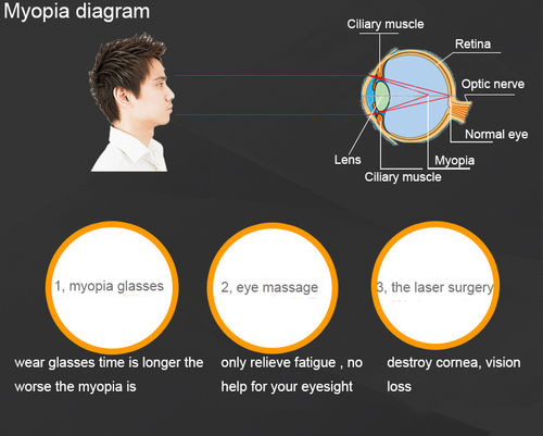 Amblyopia Cure Apparatus