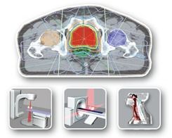 TiGRT TPS (Radiation Treatment Planning System)