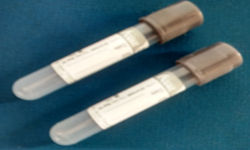 Sodium Fluoride Glucose Tube