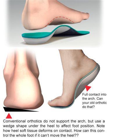 insoles for flat feet near me