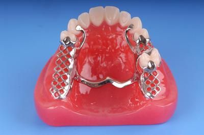 Partial Denture By ONEHIGH DENTAL LAB.