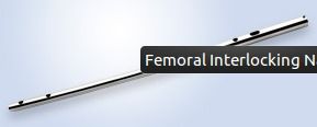 Femoral Interlocking Nail