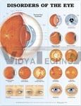 Disorders Of The Eye Anatomical Chart and Edition