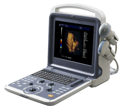 Low Power Consumption Portable 4D Color Doppler Ultrasound Machine