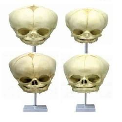 Demanded Fetal Child Skull Model