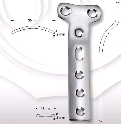 Bone T Buttress Plate