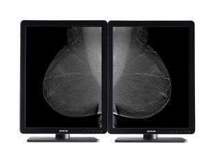 Mammography Displays
