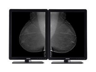 Mammography Displays Inside Diameter: 45 Millimeter (Mm)