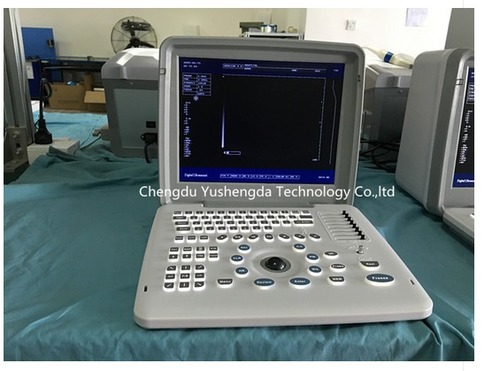 Portable Ultrasound Scanner YSD1300A By Chengdu Yushengda Technology Co., LTD