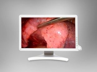 Surgical Displays