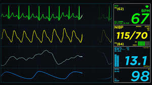 ECG Monitor - Advanced Patient Monitoring System | High-Precision Electrocardiography, Real-Time Data Display, User-Friendly Interface