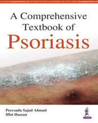 A Comprehensive Textbook of Psoriasis