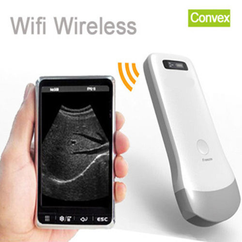 Convenience Wireless Convex Probe Ultrasound Machine Atnl-2C Dimension(L*W*H): 156A 60A 24 Millimeter (Mm)