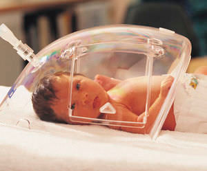 Infant Oxygen Hood