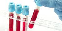 Blood Test Tube