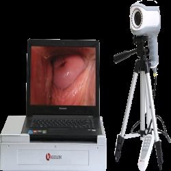 Colposcope