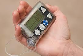 Insulin Pump - Advanced Continuous Subcutaneous Infusion Device | Enhanced Quality of Life for Diabetes Management, Freedom from Structured Meal Regimes