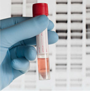 Recombinant Proteins And Enzymes