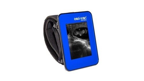 Strong & Durable Bcf Wrist Display Ultrasound Viewing Device