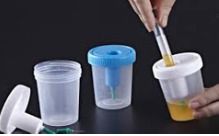 Urine Collection Container With Integrated Transfer Device - Disposable Lab Plastics