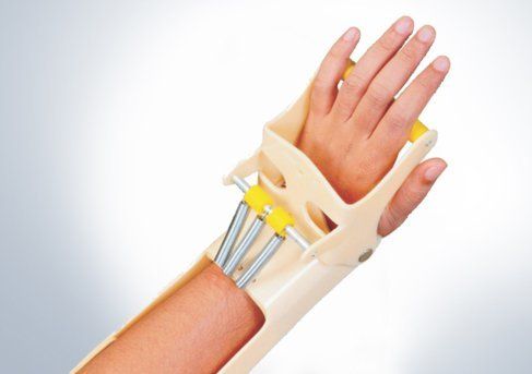 Light In Weight Dynamic Cock-up Wrist Splint A Dyna at Best Price in  Coimbatore