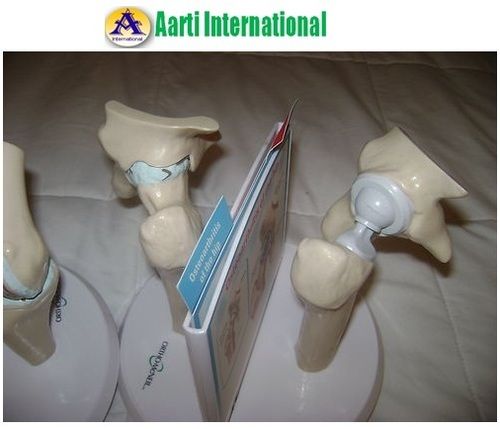 Hip Implant Anatomical Model