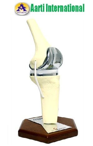 Knee Implant Model