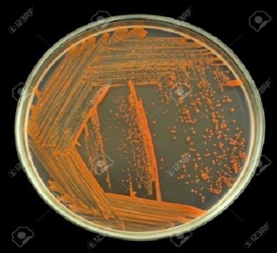 Sulphur & Iron Solubilizing Bacteria