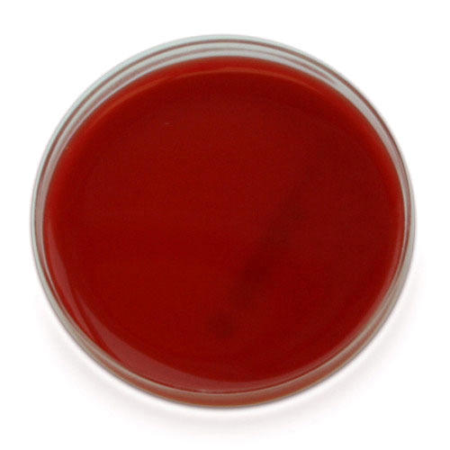 Sheep Blood Agar Plate (14x1) Box