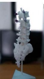 3d Printed Spine Anatomy Model Services