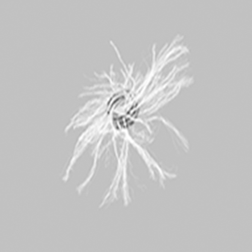 MReye Embolization Coil