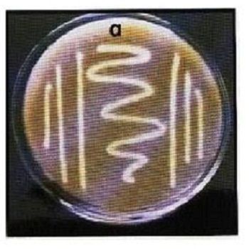 Potash Mobilizing Bacteria