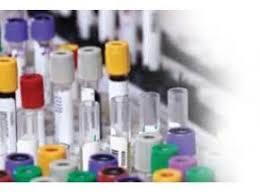 Diagnostic Reagents Chemical