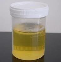 Liquid Organic Cow Urine (Gaumutra)