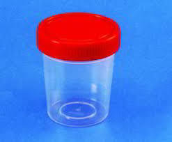 30 Ml Urine Containers
