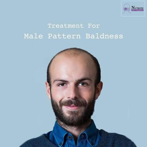 Hair Transplant Services