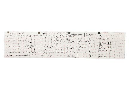 Longer Life ECG Graph Paper